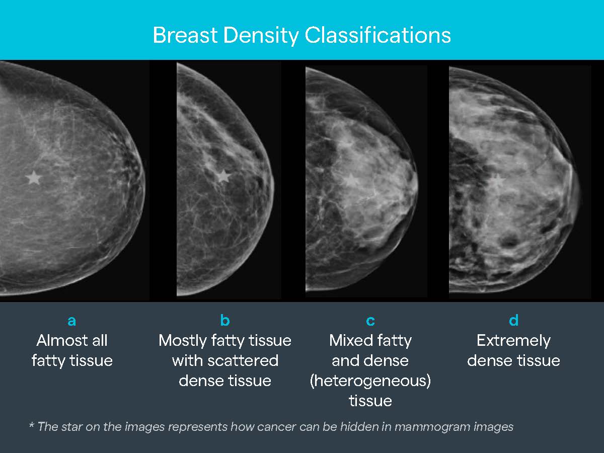 Understanding Breast Density I Med Radiology Network